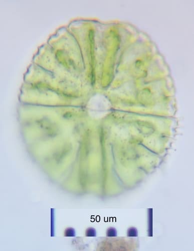 Micrasterias conferta — photo 1